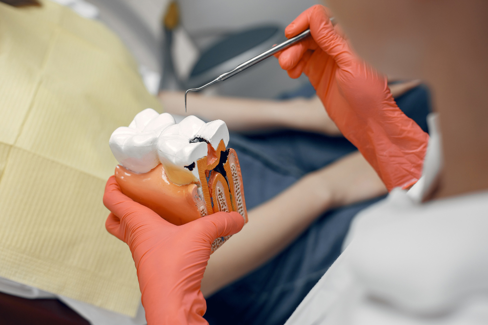 מודל שיניים לטיפול שורש